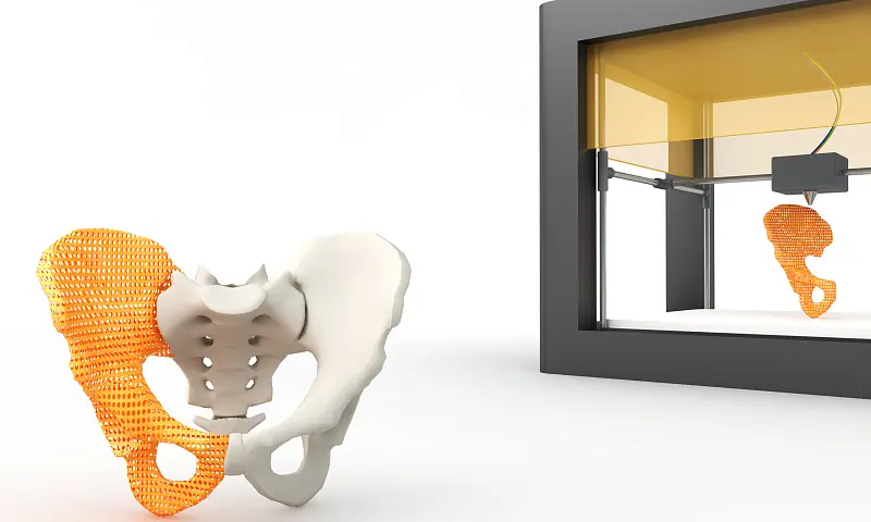 3D печать в медицине: революция в области здравоохранения